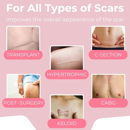 Scarxgen Silicone Gel Sheet for Scar Treatment – 6cm x 15cm